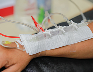 Man suffering with Chemotherapy-Induced Neuropathy