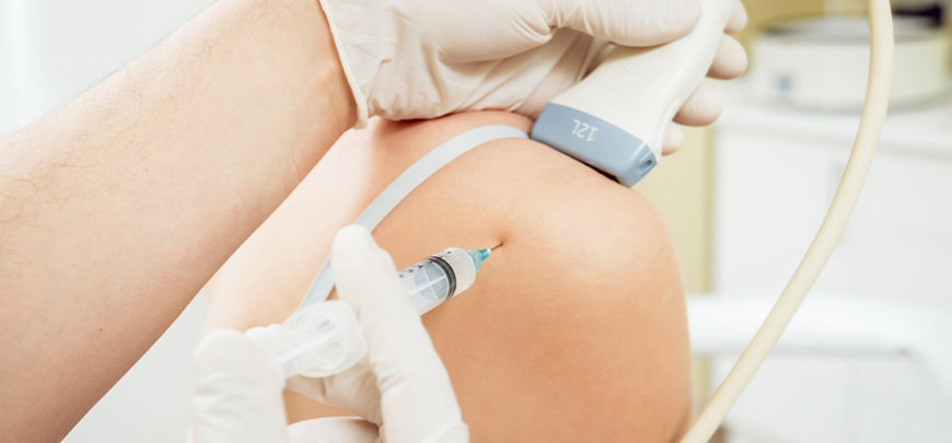trigger Point Injections being performed on patient's knee at Revive Regenerative Medical Group  in Newport Beach