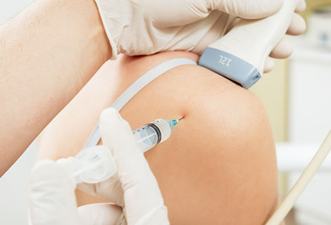 Trigger Point Injections Newport Beach