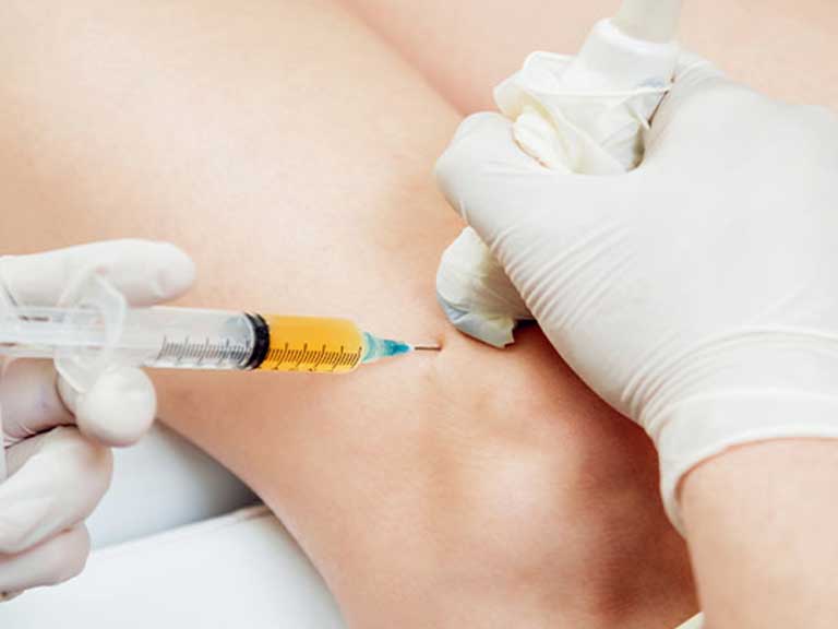 Patient recieving PRP Therapy at Revive Regenerative Medical Group in Newport Beach for joint pain relief