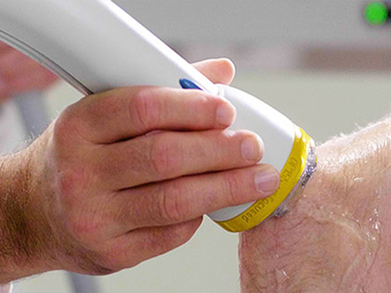 Patient recieving SoftWave Therapy at Revive Regenerative Medical Group in Newport Beach for joint pain relief